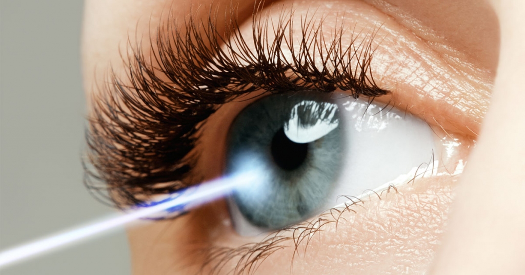 Ako prebieha laserová operácia očí?